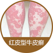 ��Ƥ��ţƤѢ��ô����