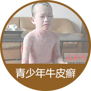 ������ţƤѢ��ô����