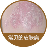 ����Ƥ������ô����